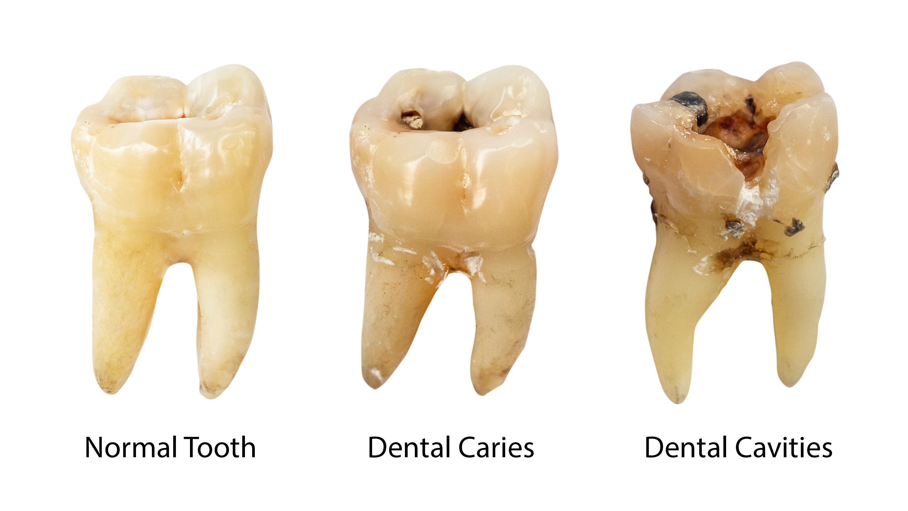 How To Make A Teeth Come Out At Minnie Zaragoza Blog